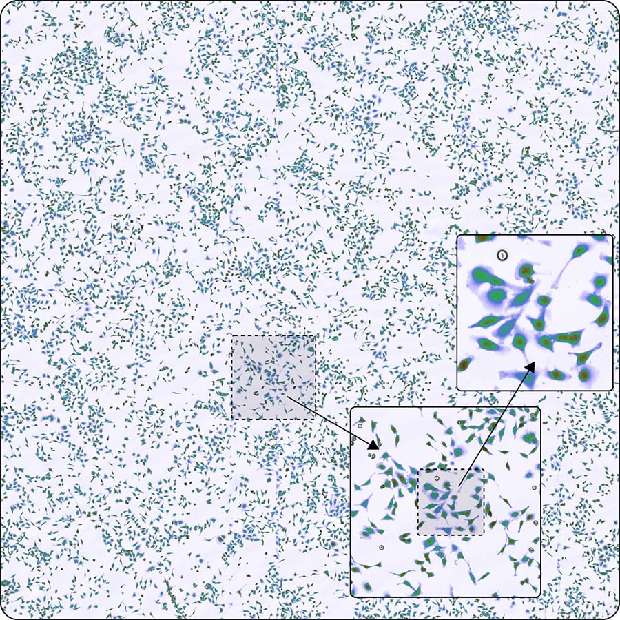 Phototransient holographic imaging is being used as a cancer detection technique at the VU Amsterdam by the Matzlab run by Matz Liebel.